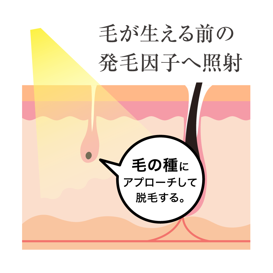 毛が生える前の発毛因子へ照射