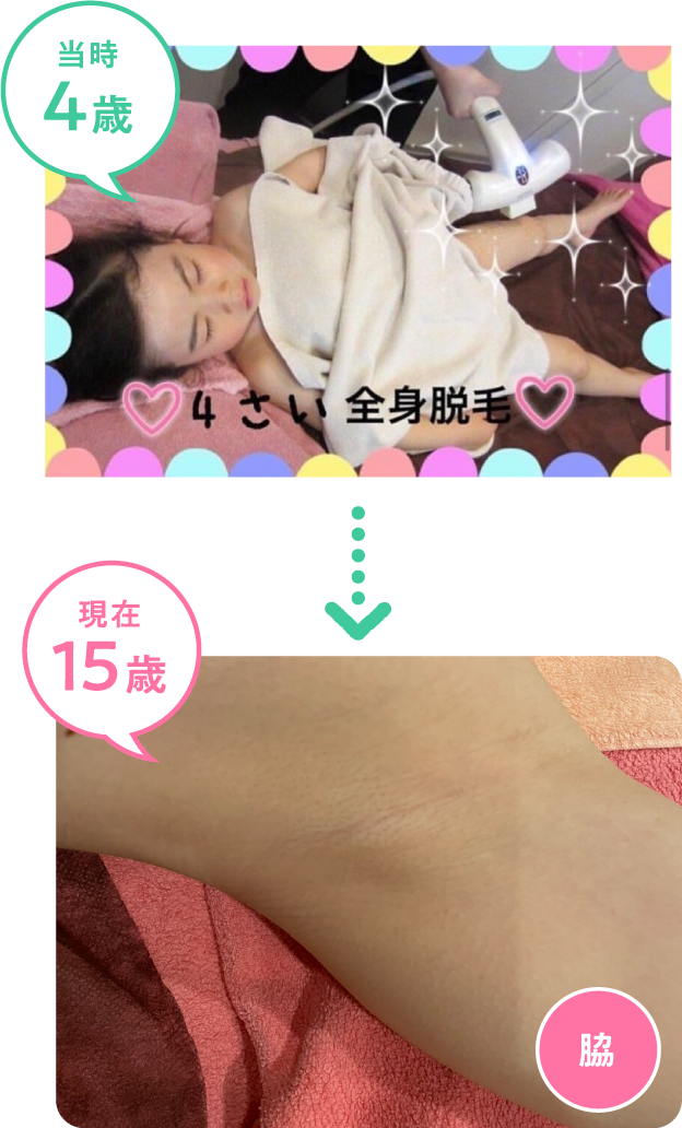 当時4歳→現在15歳