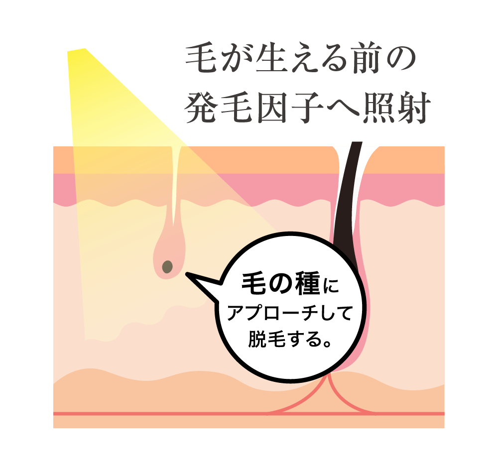 毛が生える前の発毛因子へ照射