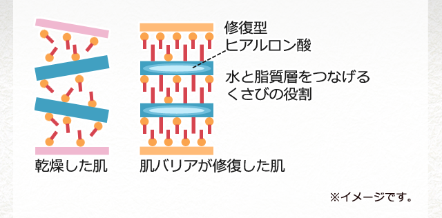 乾燥した肌 肌バリアが修復した肌：修復型ヒアルロン酸 水の皮質層をつなげるくさびの役割 